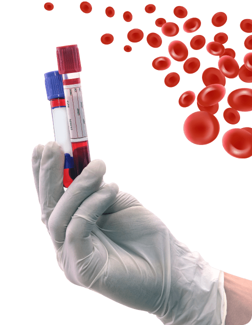 Detection of Anemia